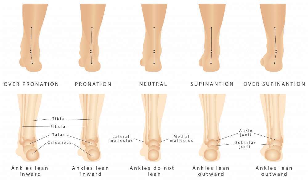 How Long Do Shoe Inserts Last