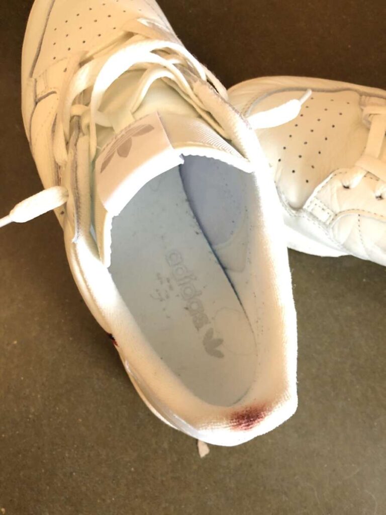 How To Get Blood Out Of Shoes