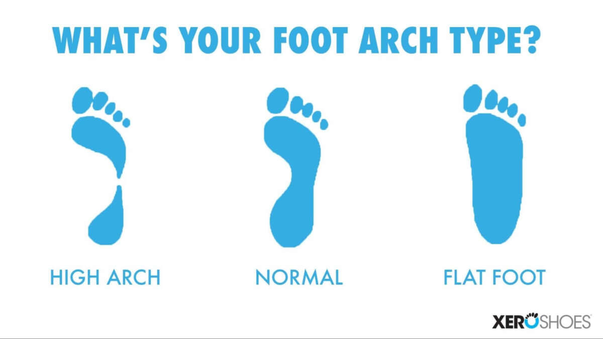 Are Barefoot Shoes Good For Flat Feet